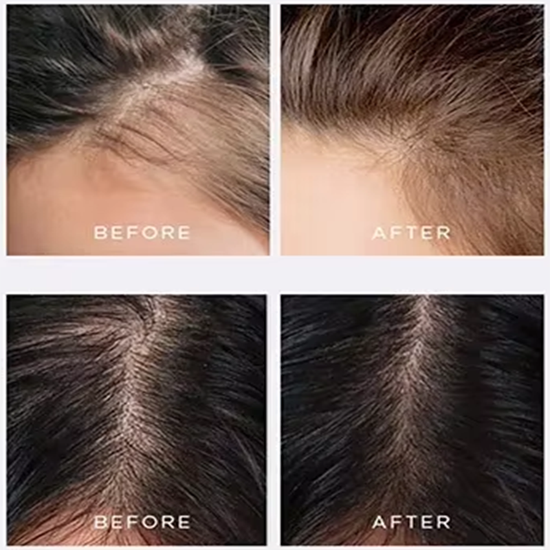 Hair growth serum